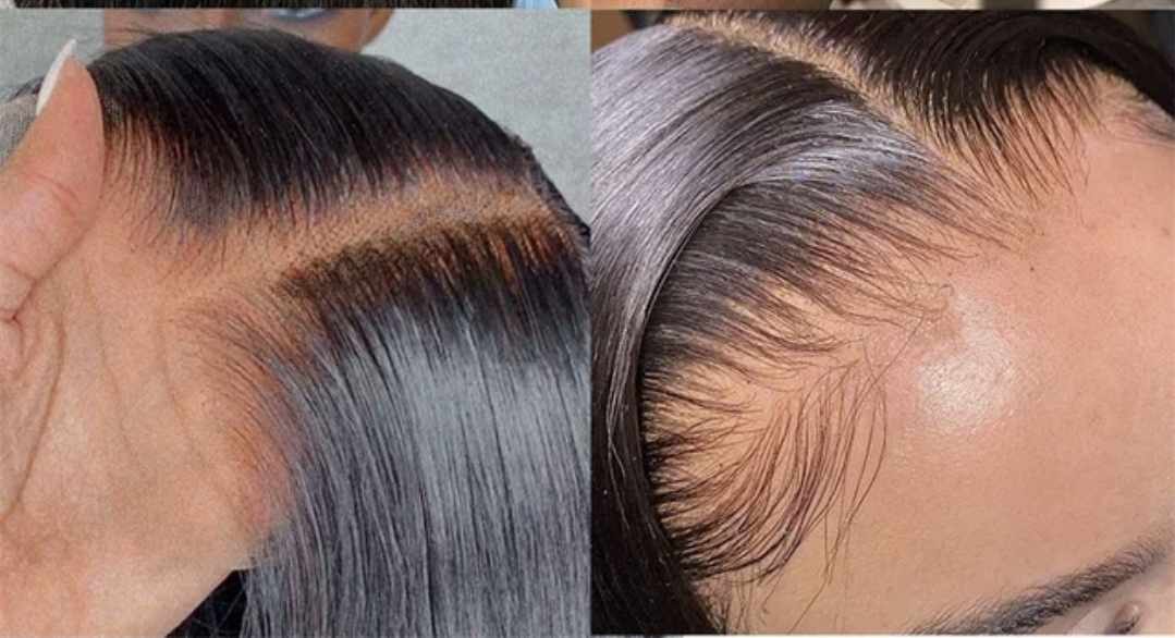 HD 5x5  Lace Closure / Frontals 13x4